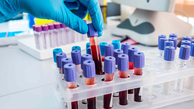 Theydon Bois Pharmacy: Private Genetic Testing in the UK