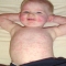 Kid Rashes - what they could mean - Tips and Things to Help A New Mom